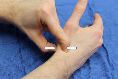 scaphoid compression axial load test|scaphoid fracture x ray.